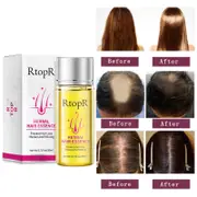 Realove 20ml Powerful Herbal Hair Growth Essence Liquid Anti-Hair Loss Essential Oil