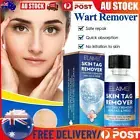 Wipe Off Skin Tags Moles Wart Remover Liquid Fast Effect Genuine WipeOff 30ML