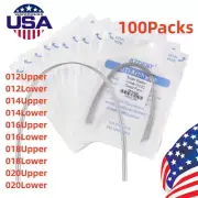 100X AZDENT Forma ovoide alambres de arco Niti superelásticos ortodoncia dental