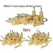 Molar Vitro Teeth Decay Caries Dental Model Dentist Tooth Student School M8024-1