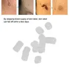 30pcs Skin Tag Remover Rubber Ring Skin Tags Skin Tag Removal Kit Accessories AU