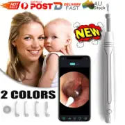 Smart Visual Earpick Ear Wax Removal Cleaner WiFi Ear Stick Endoscope Camera OY