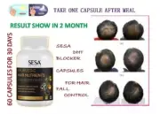 Sesa DHT Blocker Ayurvedic Hair Nutrients Vitamins (60 Capsules) 100% Herbal
