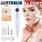 9-Level Laser Plasma Pen Dark Spot Remover Skin Wart Tag Tattoo Mole Removal Pen