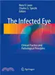 The Infected Eye ― Clinical Practice and Pathological Principles