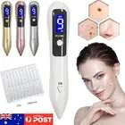 9-Gear Laser Freckle Removal Machine Skin Tag Spot Mole Wart Tattoo Remover Pen