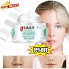 Japanese Melasma Cream,Yunnan Dr Hancy Dark Spots Correcting Cream 30g
