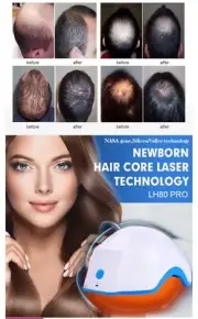 80 Diodes Red Led Hair Loss Regrowth Treatment Cap Helmet Therapy Alopecia
