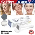 140 Pins Stamp Microneedle Roller Therapy Super 0.5mm-3mm Derma Adjustable New