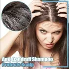 Hair Darkening Shampoo Bar Natural Darkening Shampoo Bar Hair Volumizing And DOB