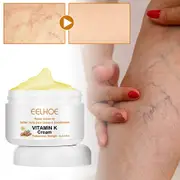 60g Vitamins K Cream for Varicose Veins Treatments Multipurpose Varicose Massage Cream for Loose Leg Axillary Vein Legs 3pcs
