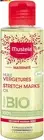 Maternity Stretch Marks Oil - for Pregnancy - 105Ml
