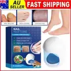 Nail Fungus Laser Device Light Therapy Onychomycosis Toes Treatment Home New