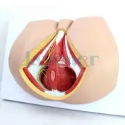 PVC Human Male Perineum Levator Ani Ligament Model Medical Anatomical Teaching