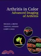 在飛比找三民網路書店優惠-Arthritis in Color: Advanced I