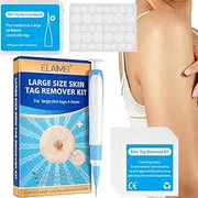 Skin Tags Remover Kit - Painless Skin Tags Remover,Remover for 4mm-9mm Sized Skin Tags, Skin Tags from Face and