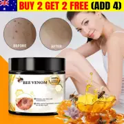 NEW Bee Venom Skin Tag Removal Treatment Cream For Body Care Mole Corn Skin Wart