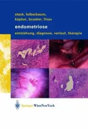 Endometriose: Entstehung, Diagnose, Verlauf und Therapie by Thomas Steck (German