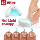 Nail Fungus Laser-Device Light Therapy Onychomycosis Toes Treatment For Home AU
