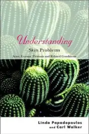 Understanding Skin Problems: Acne, Eczema, Psoriasis and Related Conditions by L