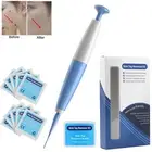 Skin Tag Remover Body Warts Acne Treatment Tool Skin Tag Removal Kit NEW AU