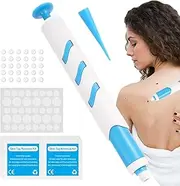Skin Tags Remover Pen | Auto Tags Removal Tool | Auto Skin Tags Remover Kit | Product Skin Tags Corrector Tool with 30 Rubber Bands for 1-4mm Skin Tags/Warts