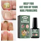Nail Fungus Treatment Repair Essence to Remove Foot Toe Fungal Anti-Infection*/