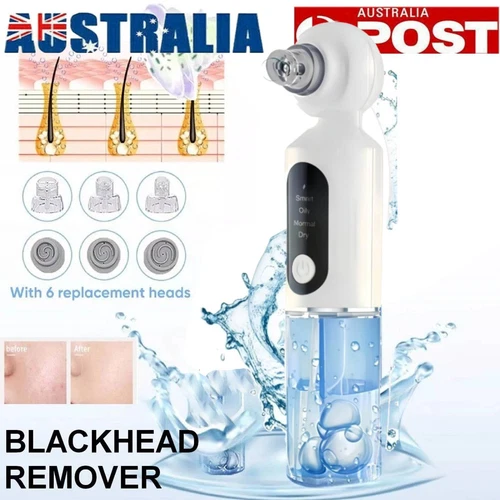 Electric Blackhead Remover Vacuum Extractor Hot Compress Water Cycle Pore Vacuum