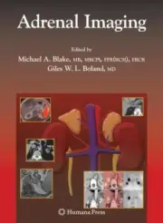 Contemporary Medical Imaging Ser.: Adrenal Imaging by Giles W. L. Boland (2009,