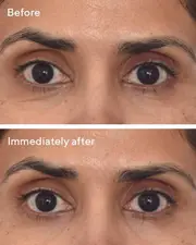 Murad Retinol Youth Renewal Eye Masks 5 Packs