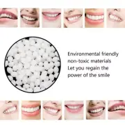100g Tooth Solid Gel Temporary Repair Kit Thermal Moldable Fitting Bead Teeth