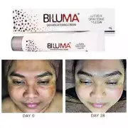 Biluma Skin Brightening Cream | For Even Skin Tone & Glow - 15gm