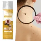 Tag Recede Bee Venom Treatment Spray Mole Remover Wart Removal For AII Skin