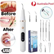 Electric Teeth Cleaner Dental Plaque Scaler Calculus Portable LED Remover USB AU