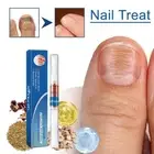 Nail Fungal Treatment Pen Anti FungusInfection Biological RepairsSolution Care&