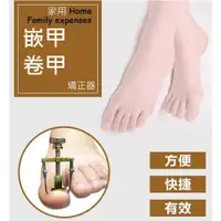 在飛比找松果購物優惠-嵌甲矯正器 腳指甲矯正器 甲溝炎 凍甲 矯正器 (3.4折)