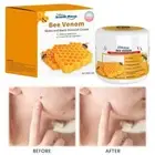 Bee-Venom Wart and Tag Remover Bee-Venom Mole & Wart Treatment-Cream-30g