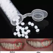 Temporary Tooth Repair Kit Teeth And Gaps False Teeth Solid Glue Denture TeeUU