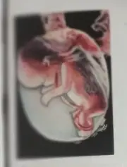 postcard inside the womb By Brandy Devoid