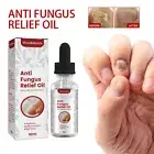 Toenail Treatment Onychomycosis Rapid Relief Oil, Onychomycosis Nail Treatment,