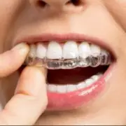 *2*Dental Retainers! Upper & Lower, ALL shipping included with *NO HIDDEN FEES!*