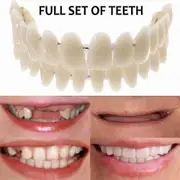 Smile Snap On False Teeth Upper Lower Dental Veneers Dentures Tooth Cover Set []