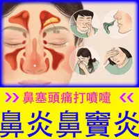 在飛比找蝦皮購物優惠-[日本进口配方]鼻炎噴劑鼻炎克星過敏性鼻炎慢性鼻竇炎鼻竇炎鼻