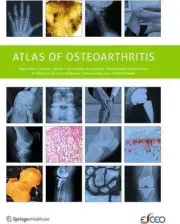Atlas of Osteoarthritis by Francisco Blanco (English) Paperback Book