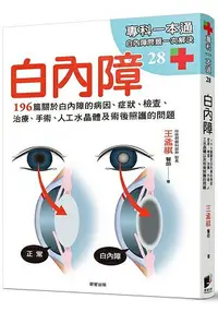 在飛比找樂天市場購物網優惠-白內障：196篇關於白內障的病因、症狀、檢查、治療、手術、人