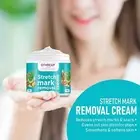 Gynocup Stretch Marks Removal Cream (50g)
