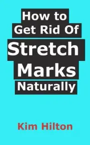 How to Get Rid Of Stretch Marks Naturally by Kim Hilton (English) Paperback Book