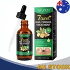 Toenail Fungus Treatment Strength Repair Growth Serum For Discolored Nails 60ML