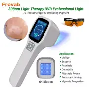 308nm Blue Best Home Uvb Light for Psoriasis UV Light Therapy for Skin Diseases