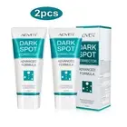 2pcs Dark Spot Remover Freckle Mole Face Skin Tone Corrector Whitening Cream